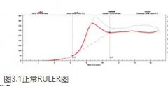 潤滑油檢測中抗氧化劑含量(RULER)是什么？